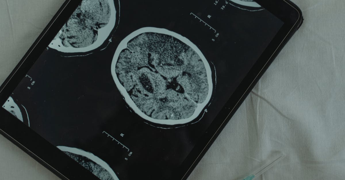 découvrez l'univers fascinant des neurosciences, une discipline qui explore le fonctionnement du cerveau et du système nerveux. apprenez comment les découvertes scientifiques influencent notre compréhension des comportements, des émotions et des troubles neurologiques.